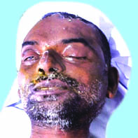 ട്രെ​യി​നി​ൽ​നി​ന്ന് വീ​ണ് ചി​കി​ത്സ​യി​ലാ​യി​രു​ന്ന അ​ജ്ഞാ​ത​ൻ മ​രി​ച്ചു