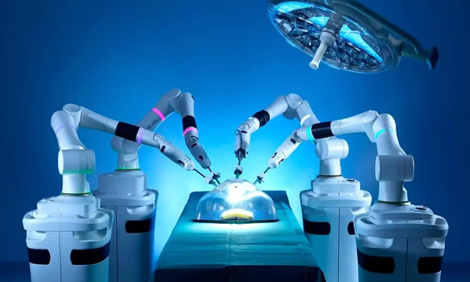 ആർ.സി.സിയിലും എം.സി.സിയിലും റോബോട്ടിക് സർജറി സംവിധാനത്തിന് 60 കോടി