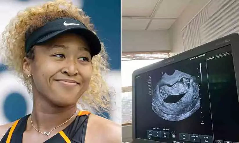 navomi osaka navomi osaka