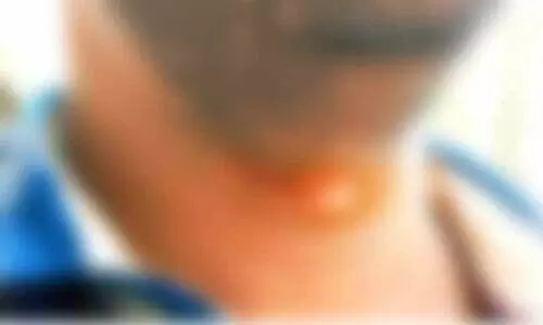 തോരണം കഴുത്തിൽ കുരുങ്ങി ഇരുചക്ര വാഹന യാത്രികന് പരിക്ക്