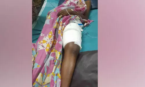 പേരക്കക്ക് കല്ലെറിഞ്ഞെന്ന് ആരോപിച്ച് മർദനം: കേസ് മാരകമായി പരിക്കേൽപിച്ചതിനും തടഞ്ഞുവെച്ചതിനും