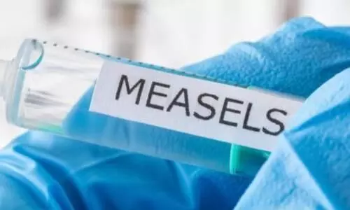 Measles