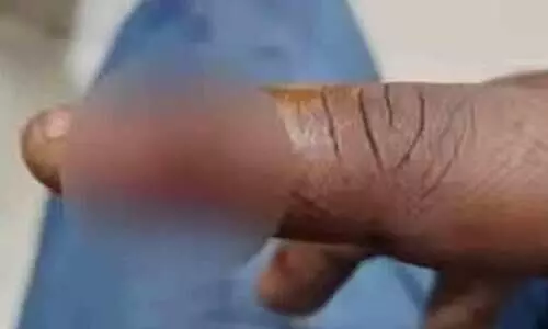 വനിതാ എസ്ഐയെ അടക്കം ചീത്തപറഞ്ഞ യുവാവ് ആംബുലൻസ് ഡ്രൈവറുടെ കൈ വിരൽ കടിച്ചു മുറിവേൽപിച്ചു വനിതാ എസ്ഐയെ അടക്കം ചീത്തപറഞ്ഞ യുവാവ് ആംബുലൻസ് ഡ്രൈവറുടെ കൈ വിരൽ കടിച്ചു മുറിവേൽപിച്ചു