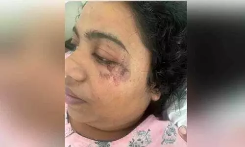 വാഹനാപകടത്തിൽ പരിക്ക്, ഗർഭഛിദ്രം; ദേശീയപാത കരാറുകാർക്കെതിരെ യുവതിയുടെ പരാതി