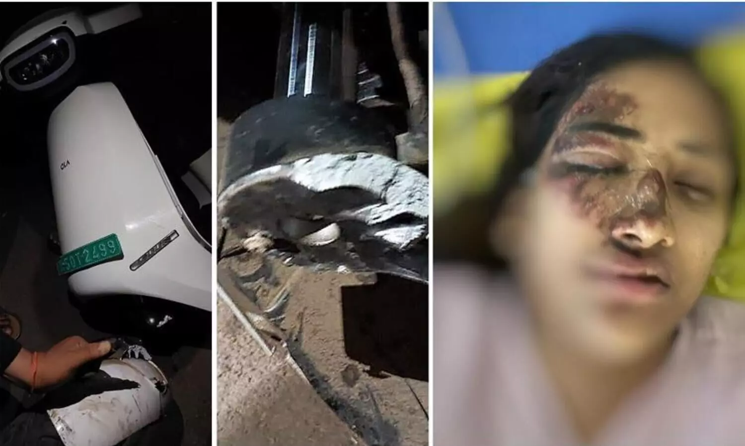 Ola S1 Pro’s front suspension breaks