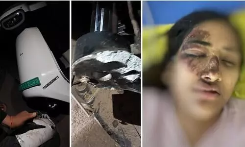 Ola S1 Pro’s front suspension breaks