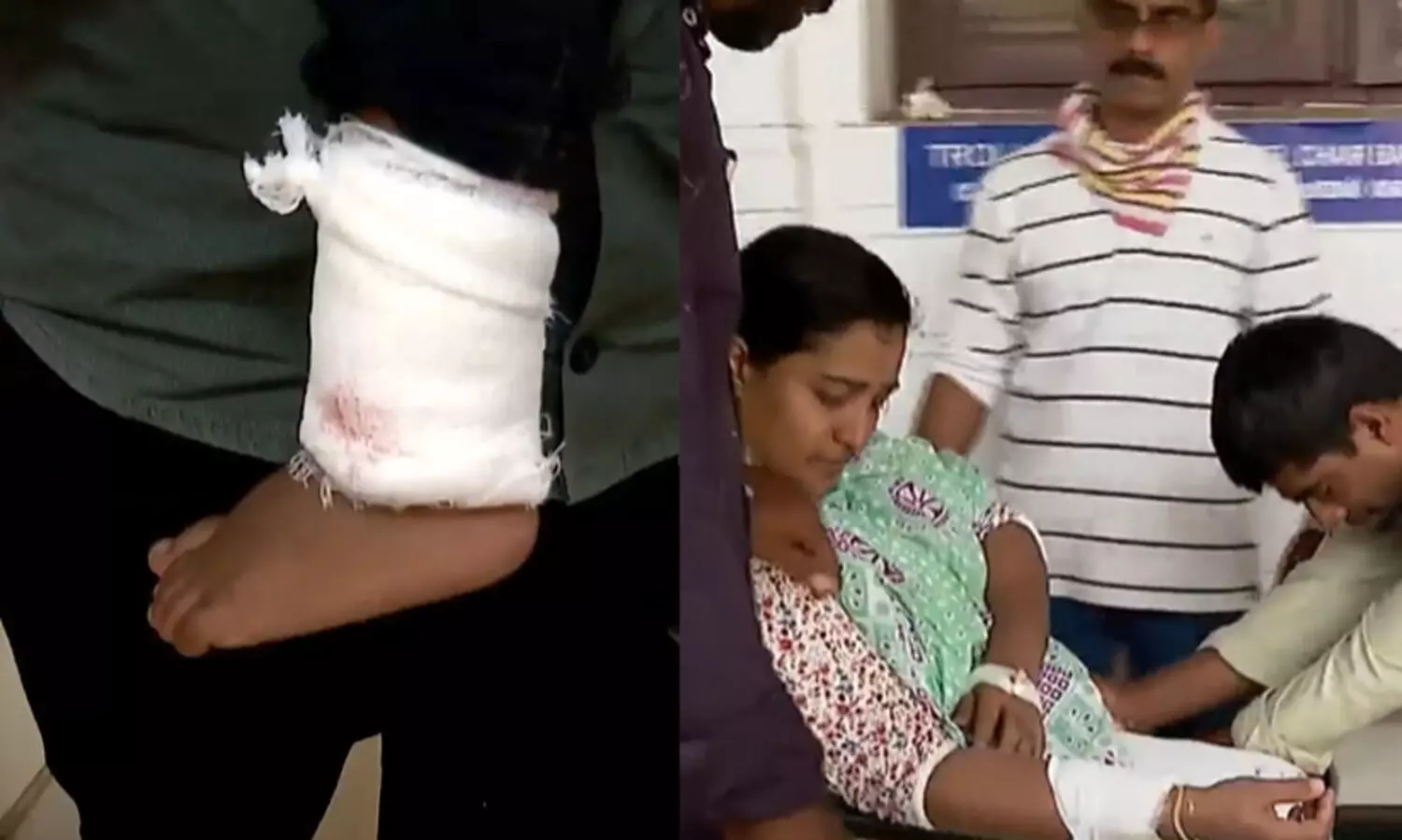 കോഴിക്കോട്ട് മൂന്നു വയസ്സുകാരനടക്കം നാലു പേർക്ക് തെരുവുനായയുടെ കടിയേറ്റു