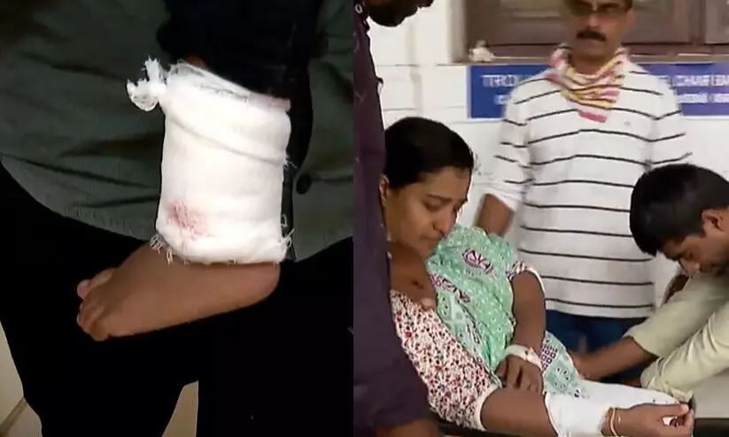 കോഴിക്കോട്ട് മൂന്നു വയസ്സുകാരനടക്കം നാലു പേർക്ക് തെരുവുനായയുടെ കടിയേറ്റു