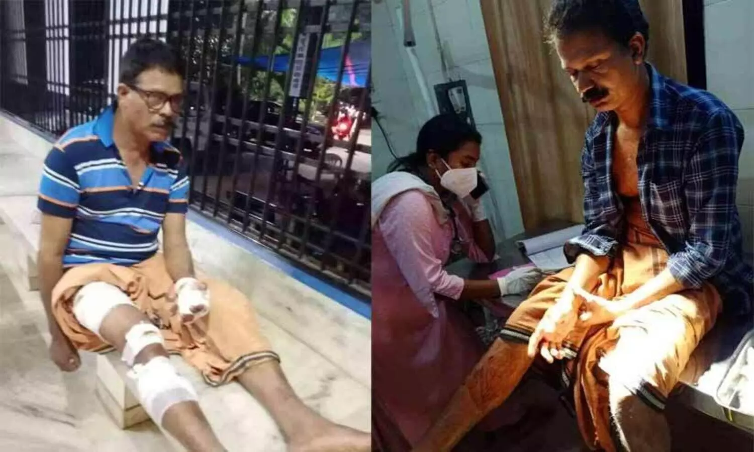 പേരാമ്പ്രയിൽ കാട്ടുപന്നിയുടെ കുത്തേറ്റ് ഏഴുപേർക്ക് പരുക്ക്