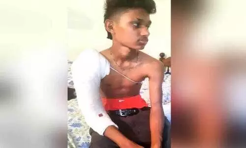 വിദ്യാർഥിക്ക് ക്രൂരമർദനം: പൊലീസ് നടപടി വൈകുന്നതായി ആക്ഷേപം വിദ്യാർഥിക്ക് ക്രൂരമർദനം: പൊലീസ് നടപടി വൈകുന്നതായി ആക്ഷേപം