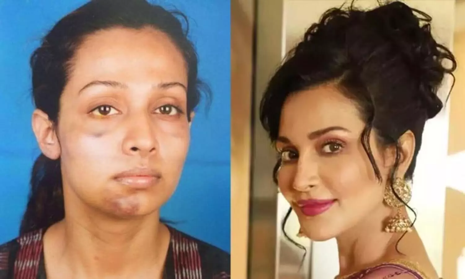Flora Saini recalls abusive relationship punch my private parts