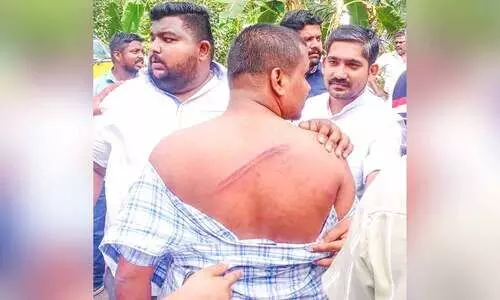 വെണ്കുറിഞ്ഞി സഹകരണ ബാങ്ക് തെരഞ്ഞെടുപ്പില് സംഘര്ഷം വെണ്കുറിഞ്ഞി സഹകരണ ബാങ്ക് തെരഞ്ഞെടുപ്പില് സംഘര്ഷം