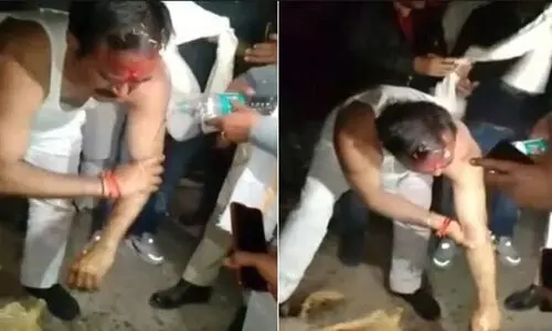 ബി.ജെ.പിയുടെ വികാസ് യാത്രക്കിടെ മന്ത്രിക്കുനേരെ ചൊറിയൻ പൊടിയേറ്; ചൊറി സഹിക്കാതെ മന്ത്രി പൊതുയിടത്തിൽ കുർത്തയഴിച്ച് കഴുകി