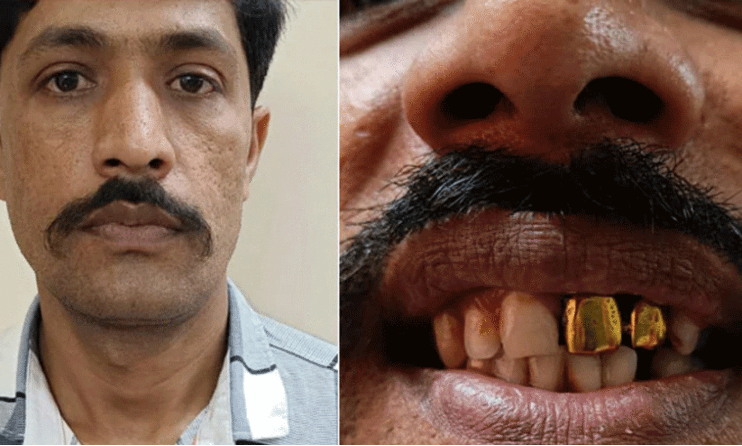 Two gold teeth help cops nab man on the run for 15 years