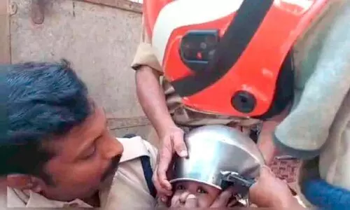 ഒന്നര വയസ്സുകാരന്റെ തലയിൽ കലം കുടുങ്ങി: അഗ്നിരക്ഷാസേന രക്ഷ​പ്പെടുത്തി