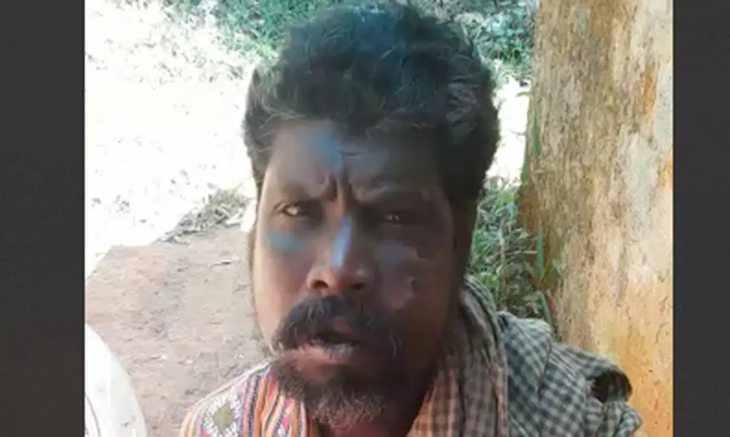 100 രൂപ കൂടുതല്‍ കൂലി ചോദിച്ച ആദിവാസി യുവാവിന് ക്രൂര മര്‍ദനം; മുഖത്ത് ചവിട്ടി, പല്ല് പോയി