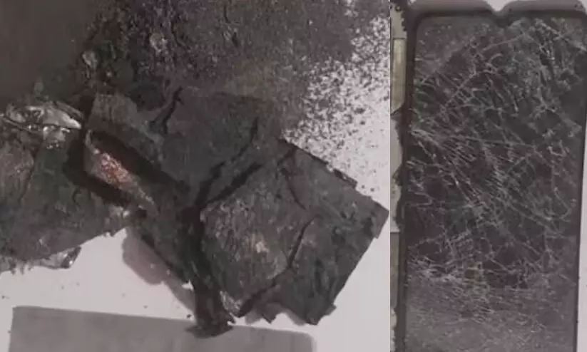 മൊബൈൽ ഫോൺ പൊട്ടിത്തെറിച്ച് പരിക്ക്