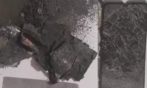 മൊബൈൽ ഫോൺ പൊട്ടിത്തെറിച്ച് പരിക്ക്