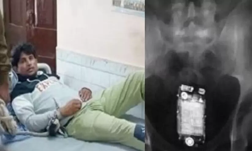 ജയിൽ പരിശോധനക്കിടെ മൊബൈൽ ഫോൺ വിഴുങ്ങി തടവുകാരൻ ജയിൽ പരിശോധനക്കിടെ മൊബൈൽ ഫോൺ വിഴുങ്ങി തടവുകാരൻ