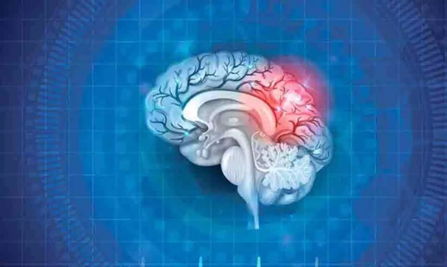 representational image