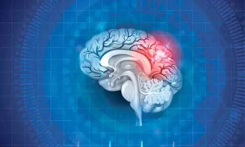 representational image