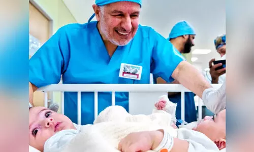 സ​യാ​മീ​സ് ഇ​ര​ട്ട​ക​ളെ വേ​ർ​പെ​ടു​ത്ത​ൽ: മൂന്നു പതിറ്റാണ്ടിനിടയിൽ സൗദിയിൽ 54 ശസ്ത്രക്രിയകൾ