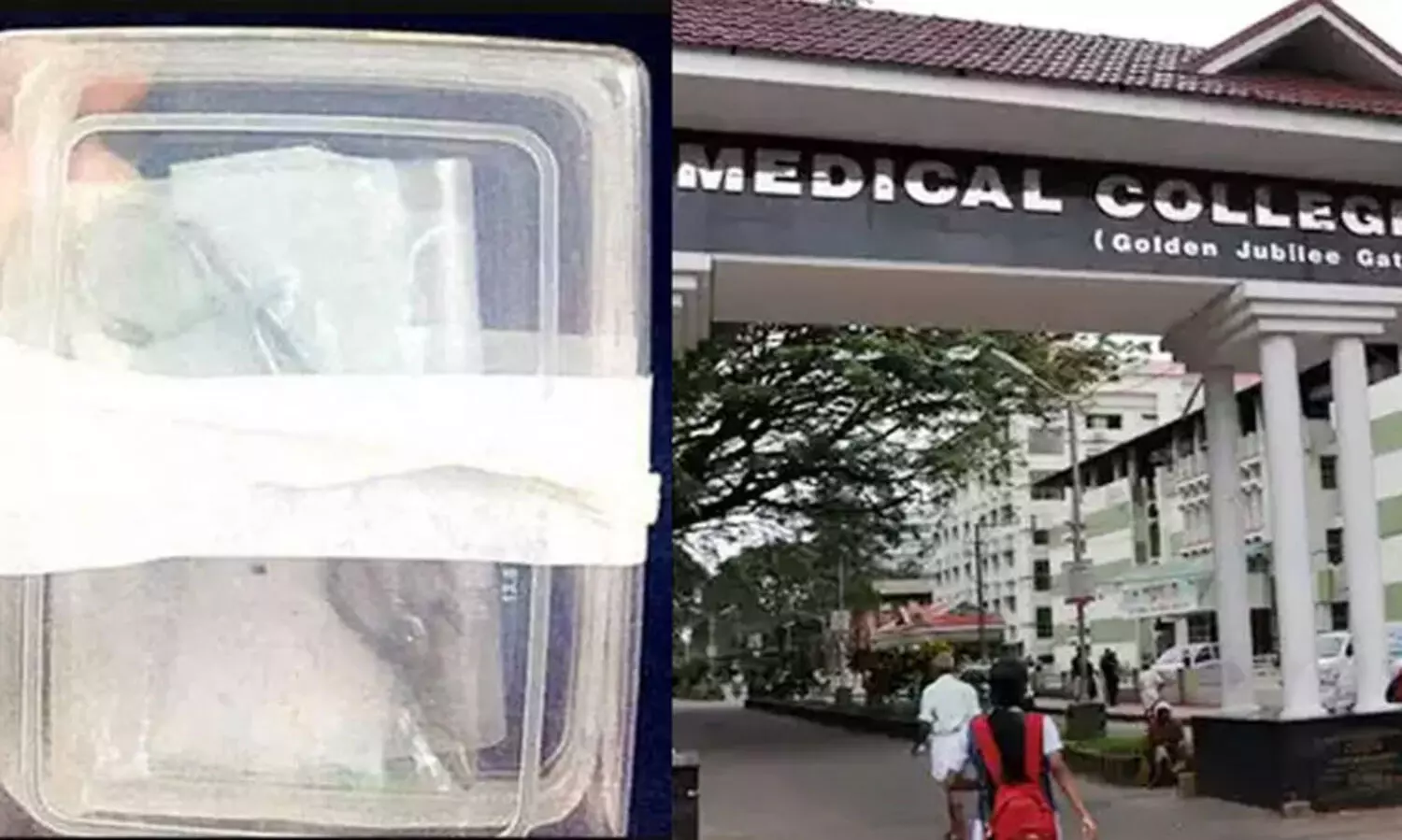 യുവതിയുടെ വയറ്റിൽ കത്രിക മറന്നുവെച്ച സംഭവം: പൊലീസ് കേസെടുത്തു