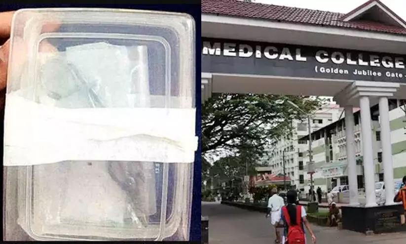 യുവതിയുടെ വയറ്റിൽ കണ്ടെത്തിയ കത്രിക കോഴിക്കോട് മെഡിക്കൽ കോളജിന്റേതല്ലെന്ന് വിദഗ്ധ സമിതി യുവതിയുടെ വയറ്റിൽ കണ്ടെത്തിയ കത്രിക കോഴിക്കോട് മെഡിക്കൽ കോളജിന്റേതല്ലെന്ന് വിദഗ്ധ സമിതി