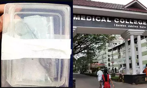 യുവതിയുടെ വയറ്റിൽ കണ്ടെത്തിയ കത്രിക കോഴിക്കോട് മെഡിക്കൽ കോളജിന്‍റേതല്ലെന്ന് വിദഗ്ധ സമിതി