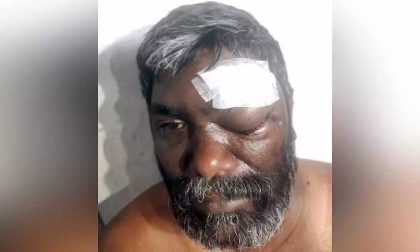 കേബിളിൽ കുരുങ്ങി ബൈക്ക് യാത്രികന്​ പരിക്ക്​