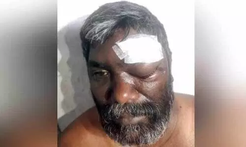 കേബിളിൽ കുരുങ്ങി ബൈക്ക് യാത്രികന്​ പരിക്ക്​