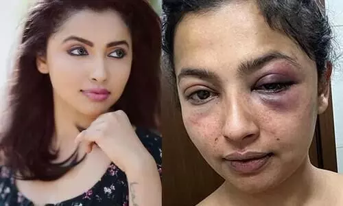 Kollywood Actress Anicka Vikhraman pens About  Attacked By Her Ex Boy Friend