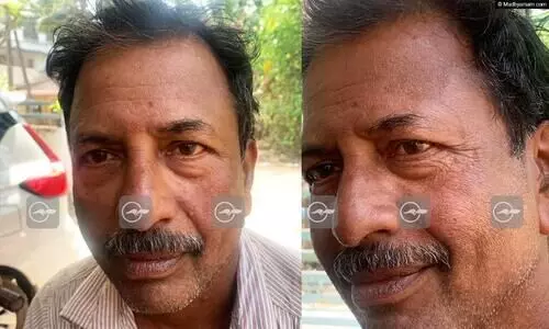 തിരുവല്ല കുറ്റൂരിൽ 55കാരന് സൂര്യാഘാതമേറ്റു