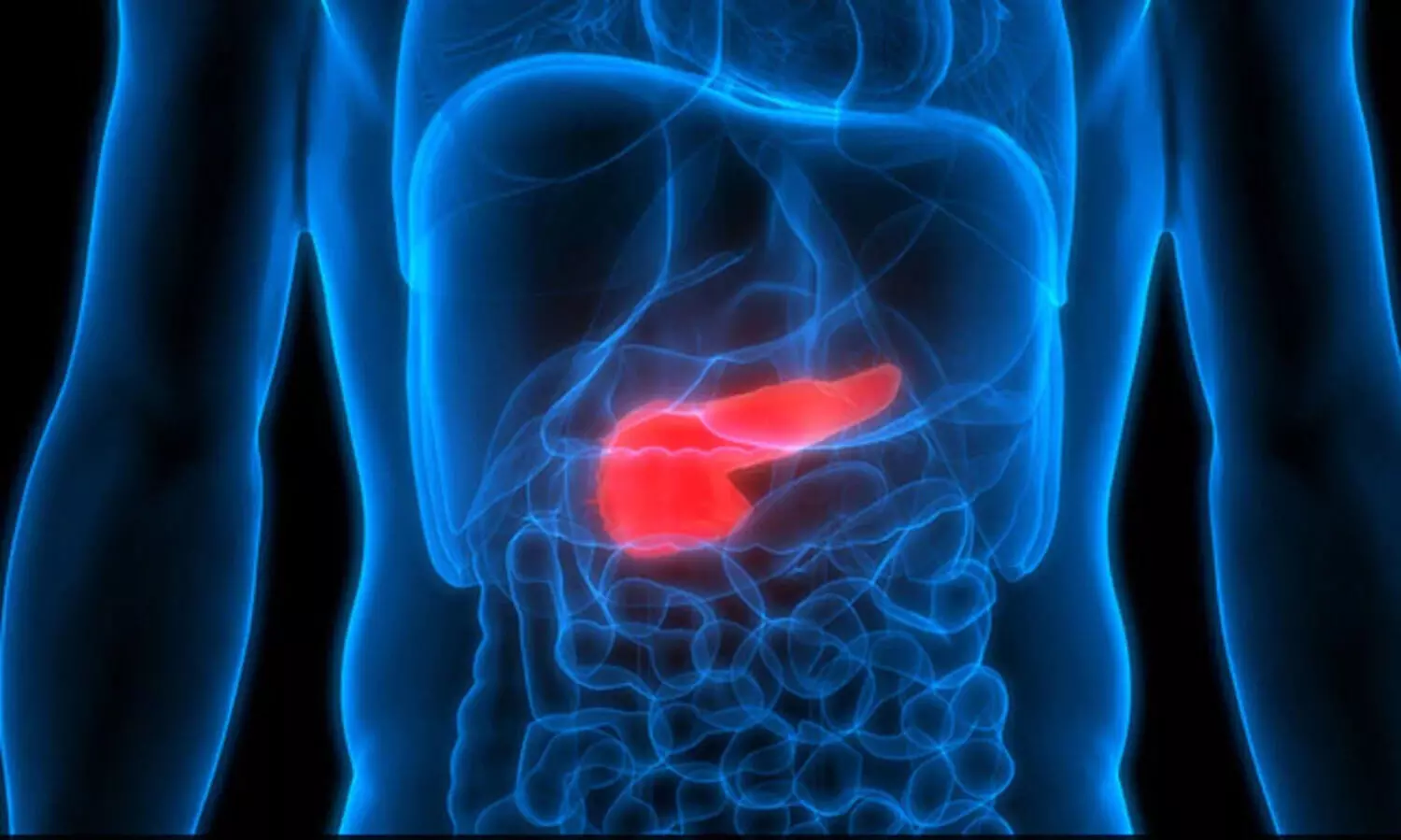 Vitamin A prevents pancreatitis