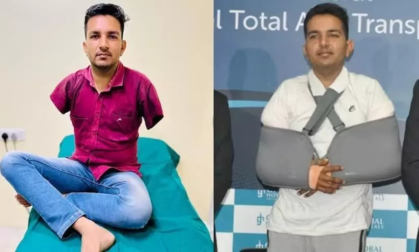 Rajasthan man becomes first Asian to undergo total arm transplant
