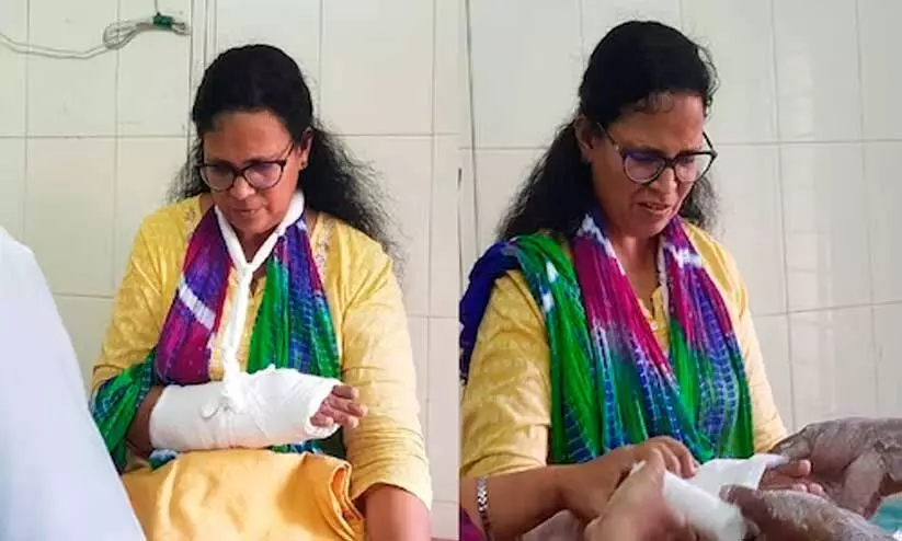കെ.കെ. രമ എം.എൽ.എയുടെ കൈക്ക് എട്ട് ആഴ്ച പ്ലാസ്റ്ററിടണമെന്ന് ഡോക്ടർമാർ കെ.കെ. രമ എം.എൽ.എയുടെ കൈക്ക് എട്ട് ആഴ്ച പ്ലാസ്റ്ററിടണമെന്ന് ഡോക്ടർമാർ