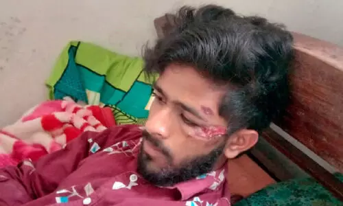 കാട്ടുപന്നി കുറുകെ ചാടി; ബൈക്ക് മറിഞ്ഞ് വിദ്യാർഥിക്ക് പരിക്ക് കാട്ടുപന്നി കുറുകെ ചാടി; ബൈക്ക് മറിഞ്ഞ് വിദ്യാർഥിക്ക് പരിക്ക്