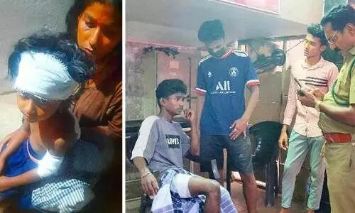 റേഷൻ കടയിലേക്ക് പന്നി പാഞ്ഞുകയറി; ബാലിക ഉൾപ്പെടെ രണ്ടുപേർക്ക് പരിക്ക്