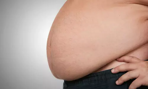 കഷണ്ടിക്കും കുടവയറിനും ‘ഒറ്റമൂലി’​; തട്ടിപ്പ്​ യാംബുവിലും