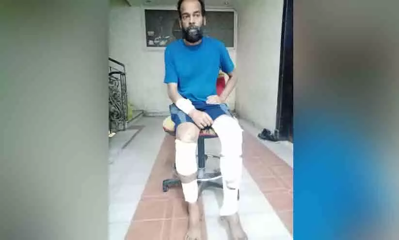 The robbers beat the legs of the Malayali The robbers beat the legs of the Malayali