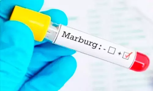 Marburg Virus Outbreak: Kuwait Advises Against Travel to Tanzania and Equatorial Guinea Marburg Virus Outbreak: Kuwait Advises Against Travel to Tanzania and Equatorial Guinea