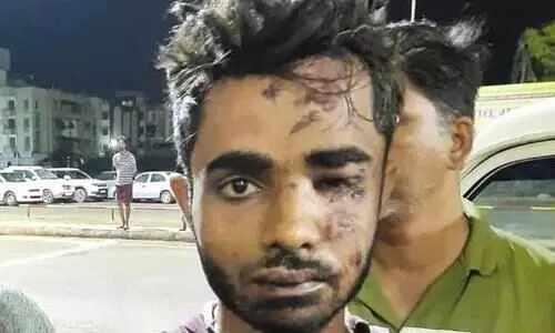 ആരോഗ്യപ്രശ്നം അനുഭവപ്പെടുന്നുണ്ടെന്ന് ഷാറൂഖ് സെയ്ഫി; ഡോക്ടറുടെ സേവനം ആവശ്യപ്പെട്ട് അന്വേഷണസംഘം