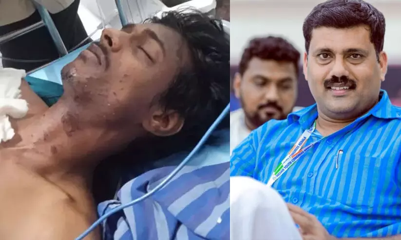 അതിർത്തിയിലേക്ക് ബോംബ് നിർമിച്ച രാജ്യസ്നേഹിയുടെ കൈ തകർന്നു എന്ന ചാണക കാപ്സ്യൂൾ വന്നോ? -റിജിൽ മാക്കുറ്റി