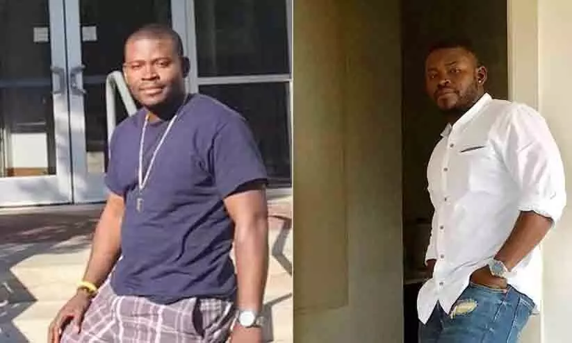 US Man spends ₹ 1.35 crore on painful surgeries to grow 5 inches taller