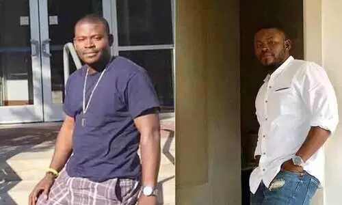 US Man spends ₹ 1.35 crore on painful surgeries to grow 5 inches taller