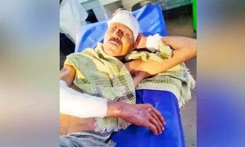 തെങ്ങുകയറ്റ തൊഴിലാളിയെ കാട്ടുപന്നിക്കൂട്ടം ആക്രമിച്ചു; കൈവിരൽ കടിച്ചെടുത്തു തെങ്ങുകയറ്റ തൊഴിലാളിയെ കാട്ടുപന്നിക്കൂട്ടം ആക്രമിച്ചു; കൈവിരൽ കടിച്ചെടുത്തു