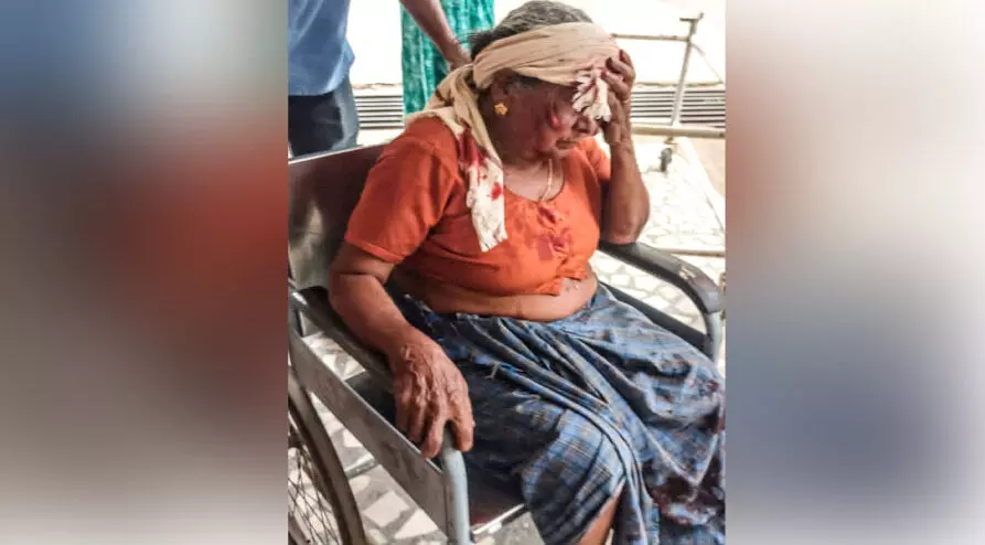 ക്ലാപ്പനയിൽ വീണ്ടും തെരുവുനായ് ആക്രമണം വയോധികക്ക്​ ഗുരുതര പരിക്ക്