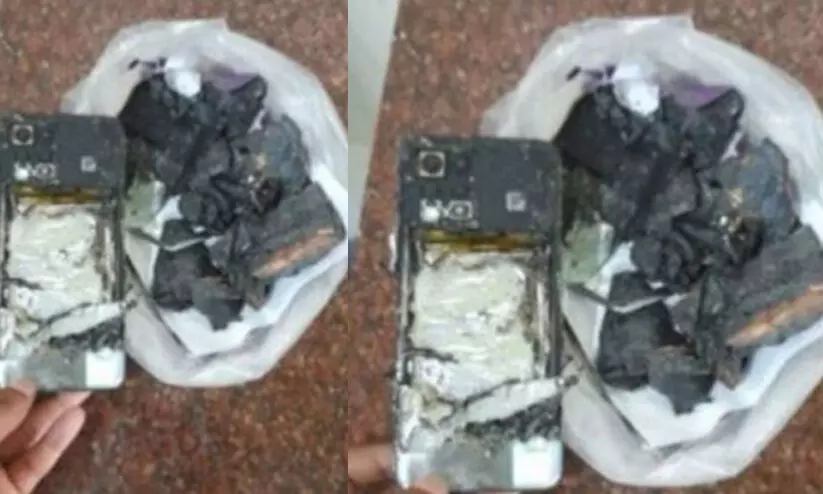 മൊബൈൽ ഫോൺ പൊട്ടിത്തെറിച്ച് യുവാവിന് പൊള്ളലേറ്റു മൊബൈൽ ഫോൺ പൊട്ടിത്തെറിച്ച് യുവാവിന് പൊള്ളലേറ്റു