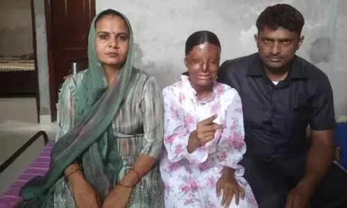 മൂന്നാം വയസ്സിൽ ആസിഡ് ആക്രമണത്തിൽ കാഴ്ച നഷ്ടപ്പെട്ടു; സ്വപ്നവിജയത്തിലേക്ക് പൊരുതിക്കയറി കഫി