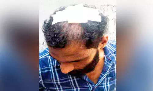 വള്ളത്തിൽ മീൻപിടിക്കുന്നതിനിടെ ആക്രമണം; രണ്ടുപേർക്ക് പരിക്ക്